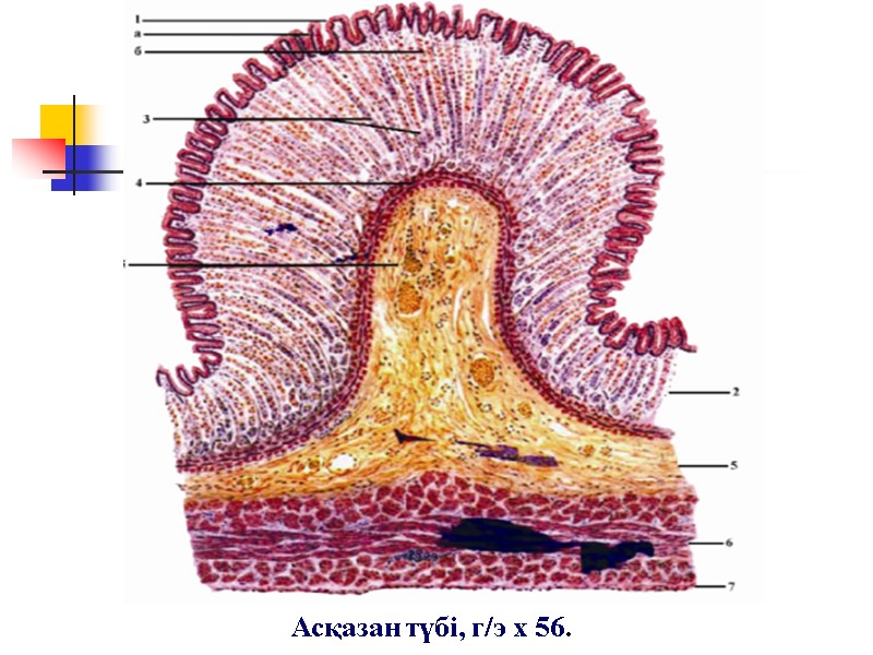 Асқазан түбі, г/э х 56.